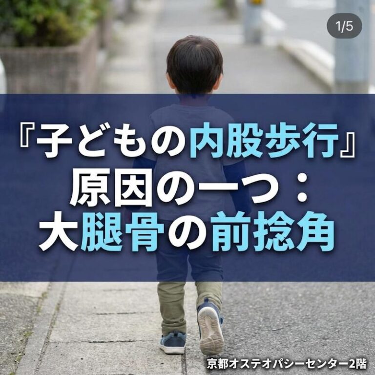 子どもの内股歩行が気になる：大腿骨（前捻角）との関係
