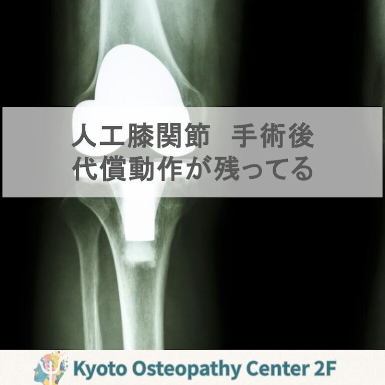 人工膝関節の手術後、歩きにくさが残るのはなぜ？代償の「後処理」が大切です