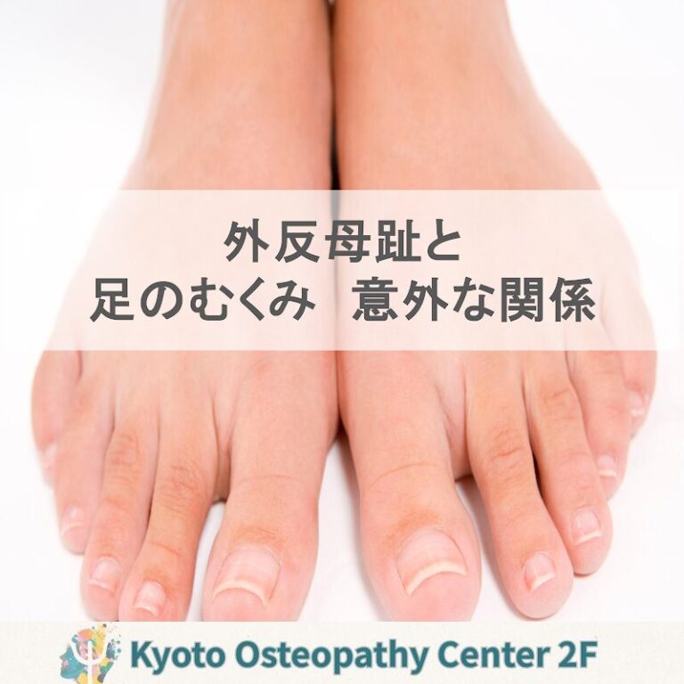 外反母趾と足のむくみ：変形の“背景”を見逃さない