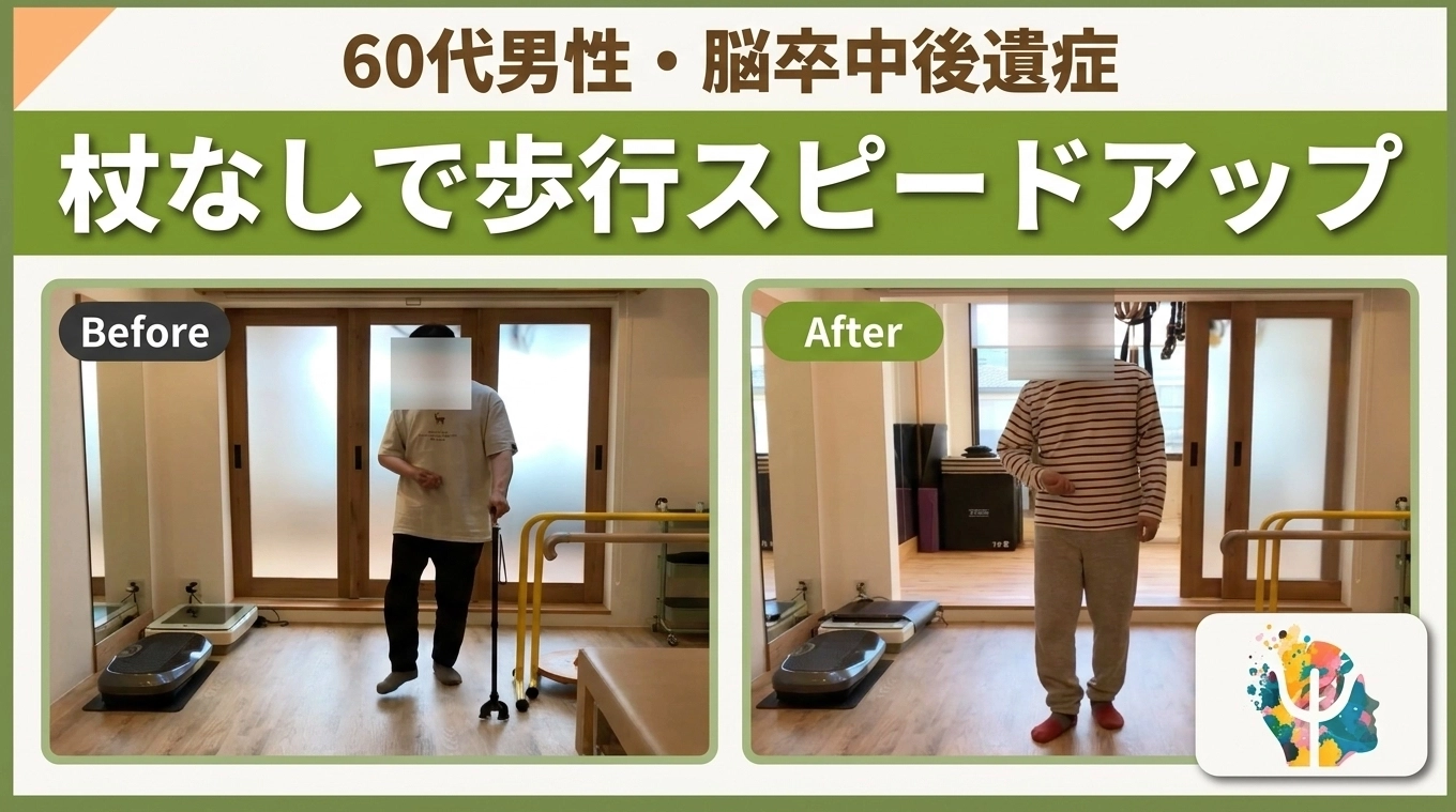 脳卒中後遺症の歩行変化を紹介するケースレポート